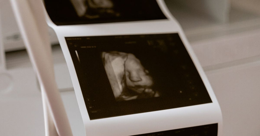 Printed ultrasound scans from a medical thermal printer — roll geometry determines which paper fits Sony 110mm and 210mm printers