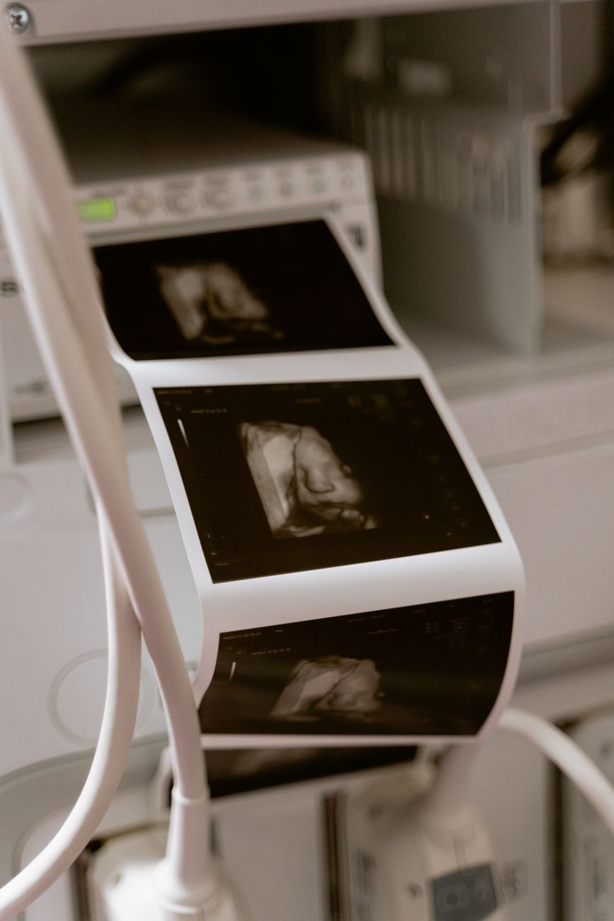 Ultrasound scan printouts on thermal paper in a clinic — bulk ultrasound paper stock for imaging centers