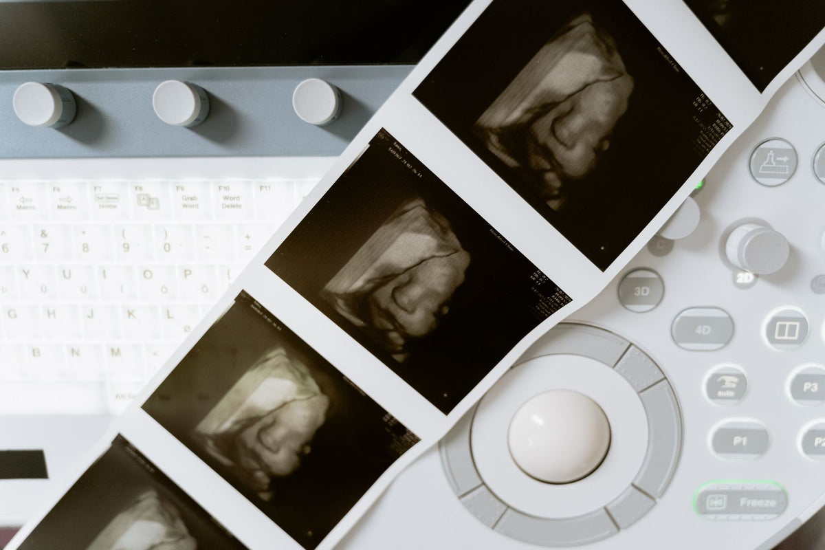 Ultrasound printout beside medical equipment, representing a paper trial on a Sony ultrasound printer