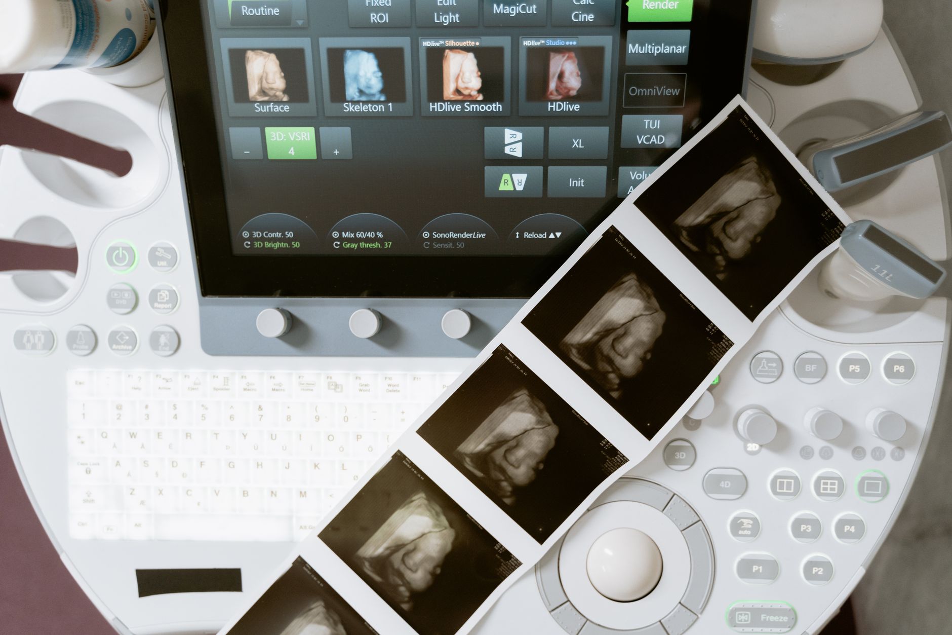 Ultrasound machine with printed sonogram images from a medical thermal printer — loading paper in a Sony UP-D898MD