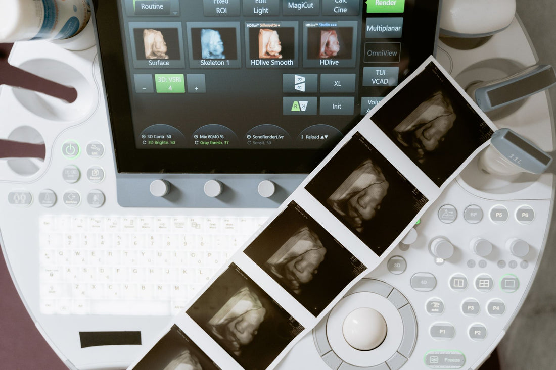 Ultrasound machine in a clinic displaying scans alongside printed thermal sonogram images
