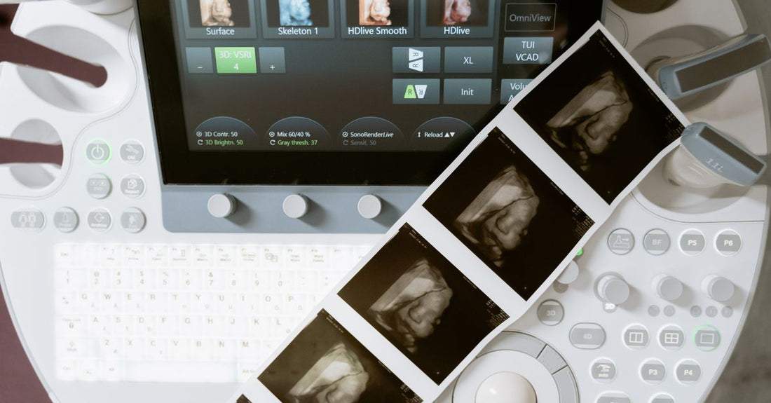 Ultrasound machine displaying a 3D scan next to printed sonogram keepsake images in a clinic