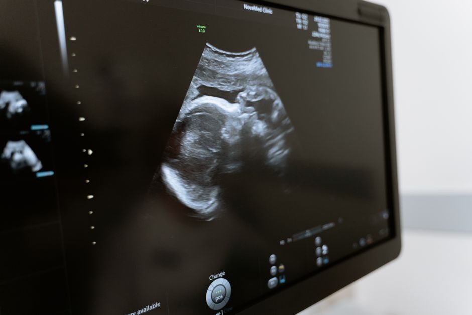 Sonographer performing an ultrasound exam beside a medical thermal video printer — legacy Sony ultrasound printer paper compatibility